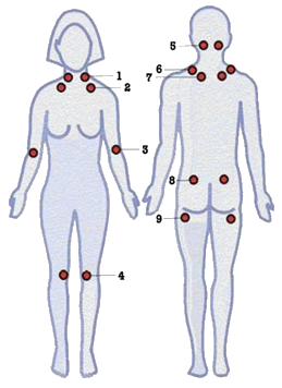 Fibromyalgie Tenderpoints